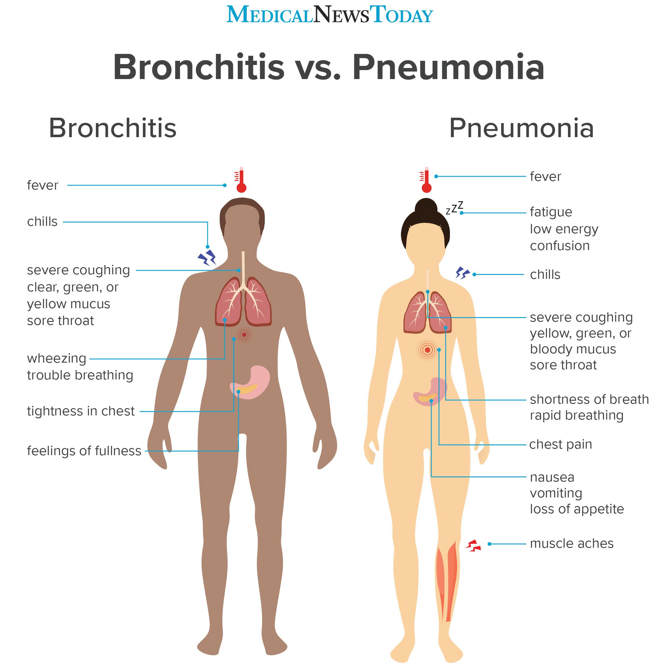 bronchitis vs pneumonia